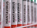Sağlık Bakanlığı'ndan hantavirüs açıklaması: Türkiye'de vaka tespit edildi mi?