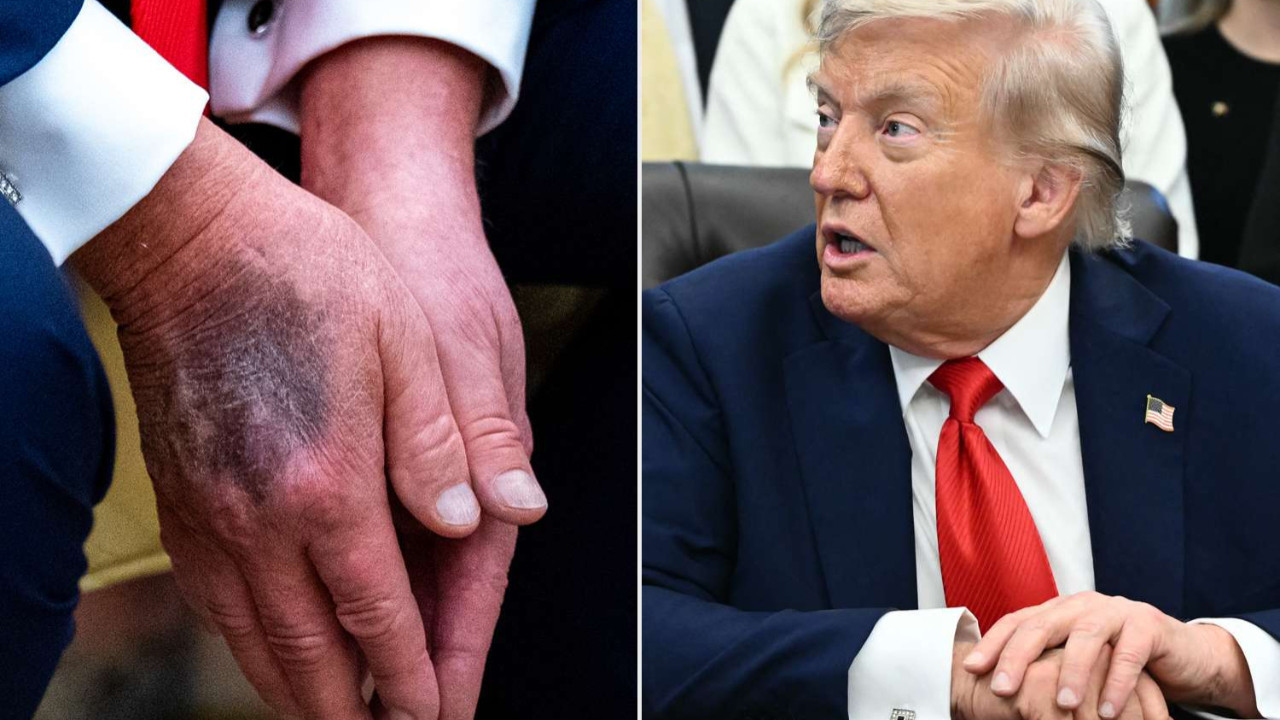 Elindeki morluklar dikkat çekmişti! Trump sebebini açıkladı