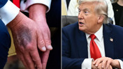 Elindeki morluklar dikkat çekmişti! Trump sebebini açıkladı