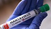 ABD ve İngiltere'de hantavir&uuml;s alarmı