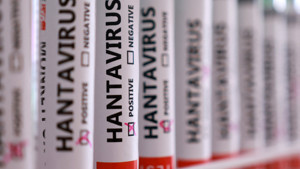 Sağlık Bakanlığı'ndan hantavirüs açıklaması: Türkiye'de vaka tespit edildi mi?