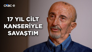 Bir Süre Ümitsizdim, Kansere Karşı Başarılı Olamayacağımı Düşündüm! | Oktay Güner