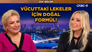 Güzellik Uzmanı Suna Dumankaya'dan Yaşlanmaya Karşı Özel Formül! | Lekeler İçin Doğal Gece Kremi!