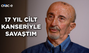 Bir Süre Ümitsizdim, Kansere Karşı Başarılı Olamayacağımı Düşündüm! | Oktay Güner