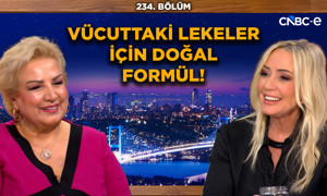 Güzellik Uzmanı Suna Dumankaya'dan Yaşlanmaya Karşı Özel Formül! | Lekeler İçin Doğal Gece Kremi!