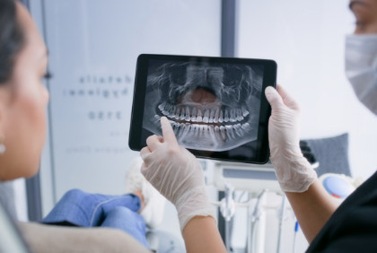 Dolgu ve implant dönemi bitiyor mu? Kök hücreyle canlı diş dönemi!