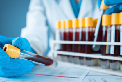 Kolon kanseri taraması için geliştirilen kan testine FDA'dan onay