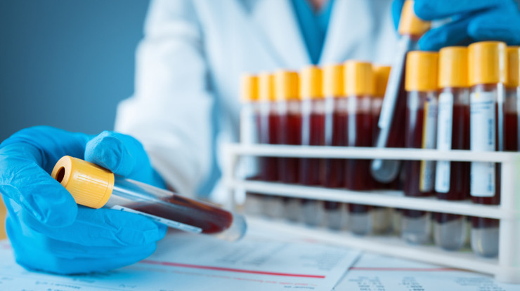 Kolon kanseri taraması için geliştirilen kan testine FDA'dan onay