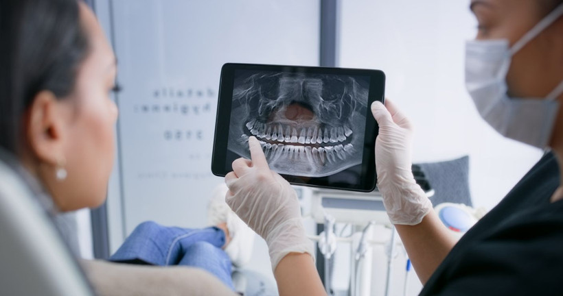 Dolgu ve implant dönemi bitiyor mu? Kök hücreyle canlı diş dönemi! - Resim: 4