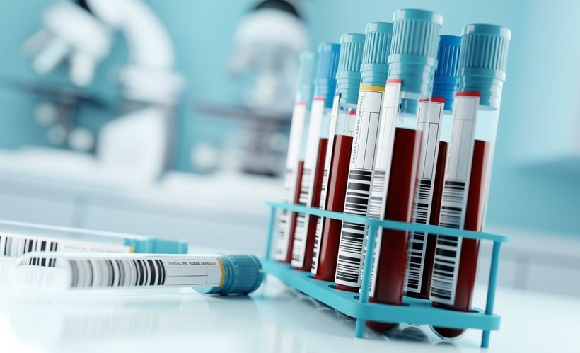 Kanser tespitinde çığır açan kan testi için kritik adım! FDA'dan olumlu sinyal - Resim: 3