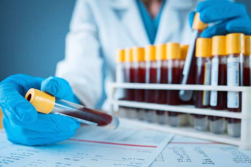 Kanser tespitinde çığır açan kan testi için kritik adım! FDA'dan olumlu sinyal - Resim: 4
